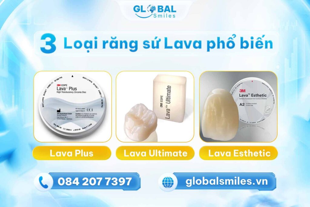 các dòng răng sứ lava phổ biến hiên nay
