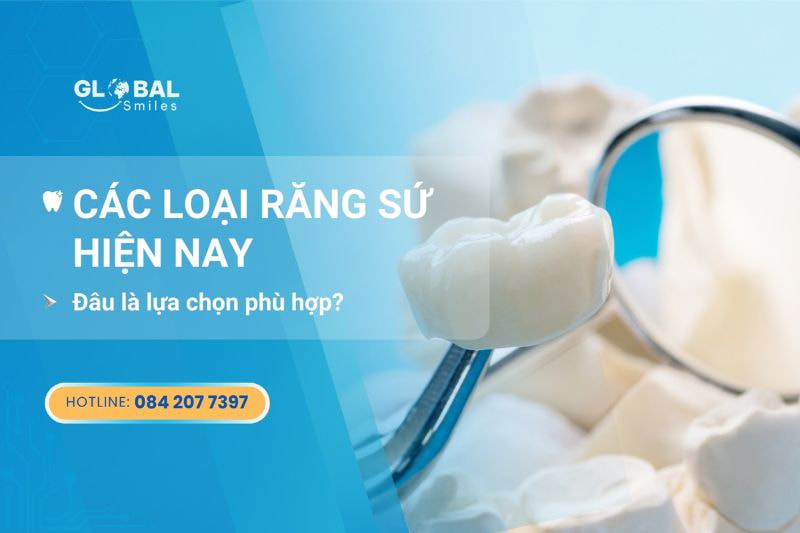 Các loại răng sứ thịnh hành hiện nay – Đâu là lựa phù hợp?