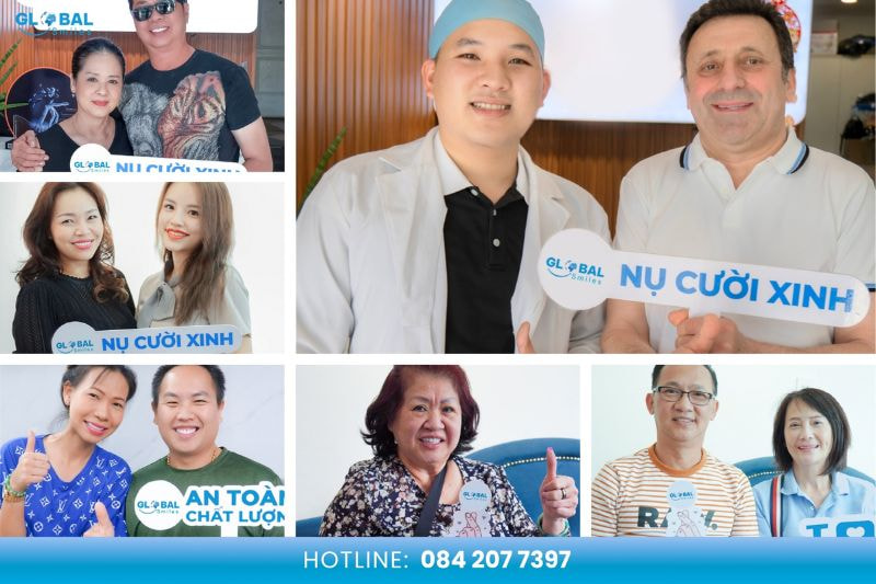 Hình ảnh khách hàng bọc răng sứ tại Nha khoa Global Smile