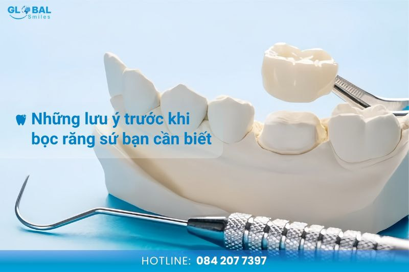 Những lưu ý trước khi bọc răng sứ