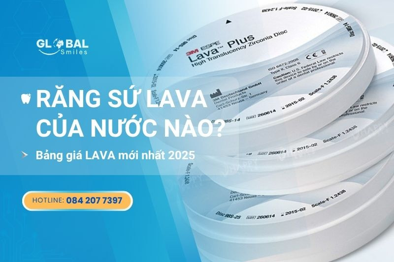 Răng sứ Lava của nước nào? Có tốt không? Giá Lava mới nhất