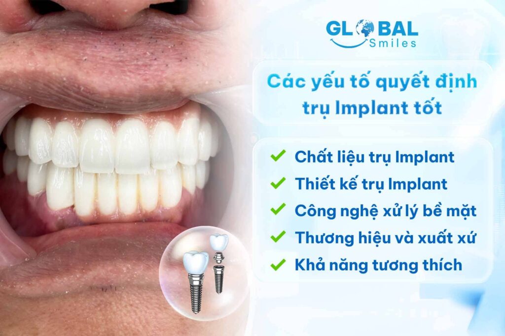 Các yếu tố quyết định trụ Implant tốt